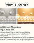 Before and after using Mixsoon Bean Essence – Noticeable improvement in skin texture with smoother, brighter, and more radiant skin.