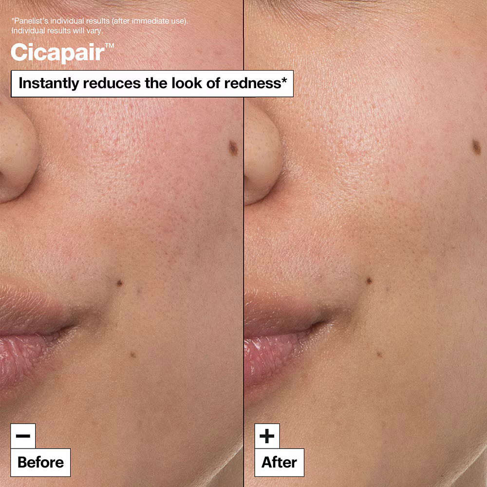 Soft, smooth skin after using Dr. Jart Cicapair Cream – hydrates and protects the skin barrier