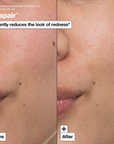 Soft, smooth skin after using Dr. Jart Cicapair Cream – hydrates and protects the skin barrier