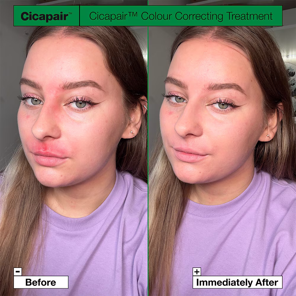 Before and after using Dr. Jart Cicapair Tiger Grass Color Correcting Treatment – visibly reduced redness and smoother, more even skin