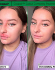 Before and after using Dr. Jart Cicapair Tiger Grass Color Correcting Treatment – visibly reduced redness and smoother, more even skin