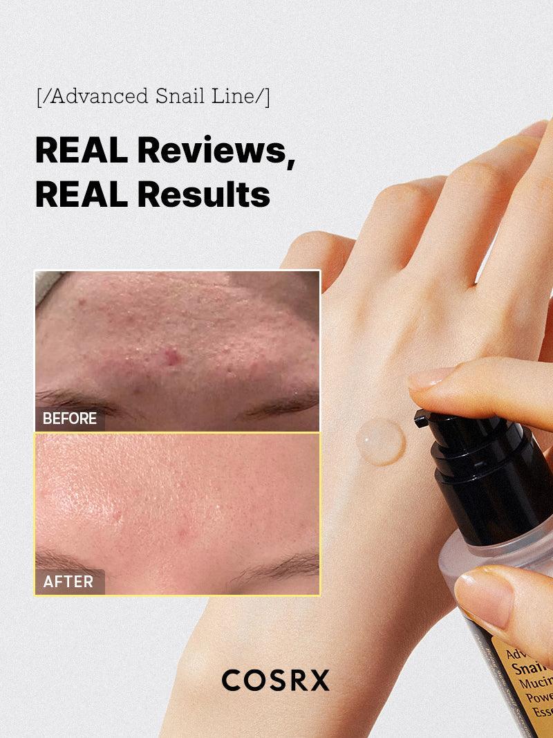 Close-up of Cosrx Advanced Snail 96 Mucin Power Essence – Non-sticky, fast-absorbing serum that hydrates and repairs the skin with 96% snail secretion filtrate