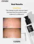 Before and after using Cosrx BHA Blackhead Power Liquid – Reduced blackheads and smoother skin texture for a clearer complexion