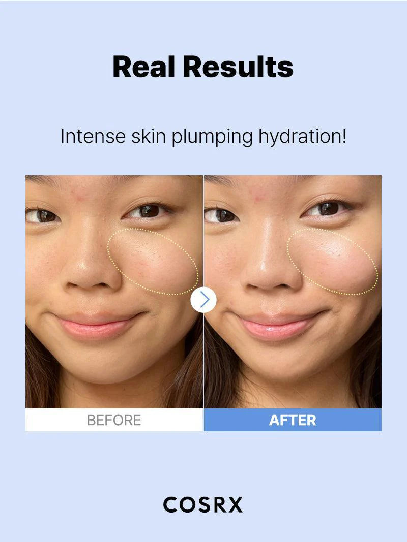 COSRX Hyaluronic Acid Serum 20ml – Fragrance-free serum with 3% hyaluronic acid, absorbs quickly, hydrates deeply, and supports a glowing, smooth complexion