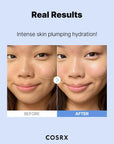 COSRX Hyaluronic Acid Serum 20ml – Fragrance-free serum with 3% hyaluronic acid, absorbs quickly, hydrates deeply, and supports a glowing, smooth complexion