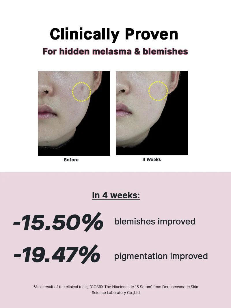COSRX Niacinamide 15 Serum on a vanity – brightening and acne-fighting serum ideal for oily and uneven skin