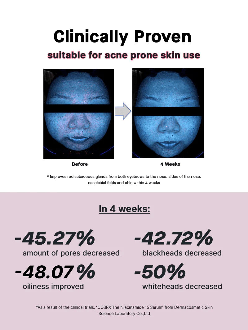 COSRX Niacinamide 15 Serum on a vanity – brightening and acne-fighting serum ideal for oily and uneven skin