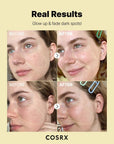 Applying Cosrx Vitamin C 23 Serum – helps brighten skin, reduce dark spots, and improve skin elasticity with a moisturizing finish