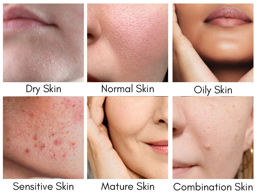 Oily skin, dry skin, combination skin, sensitive skin