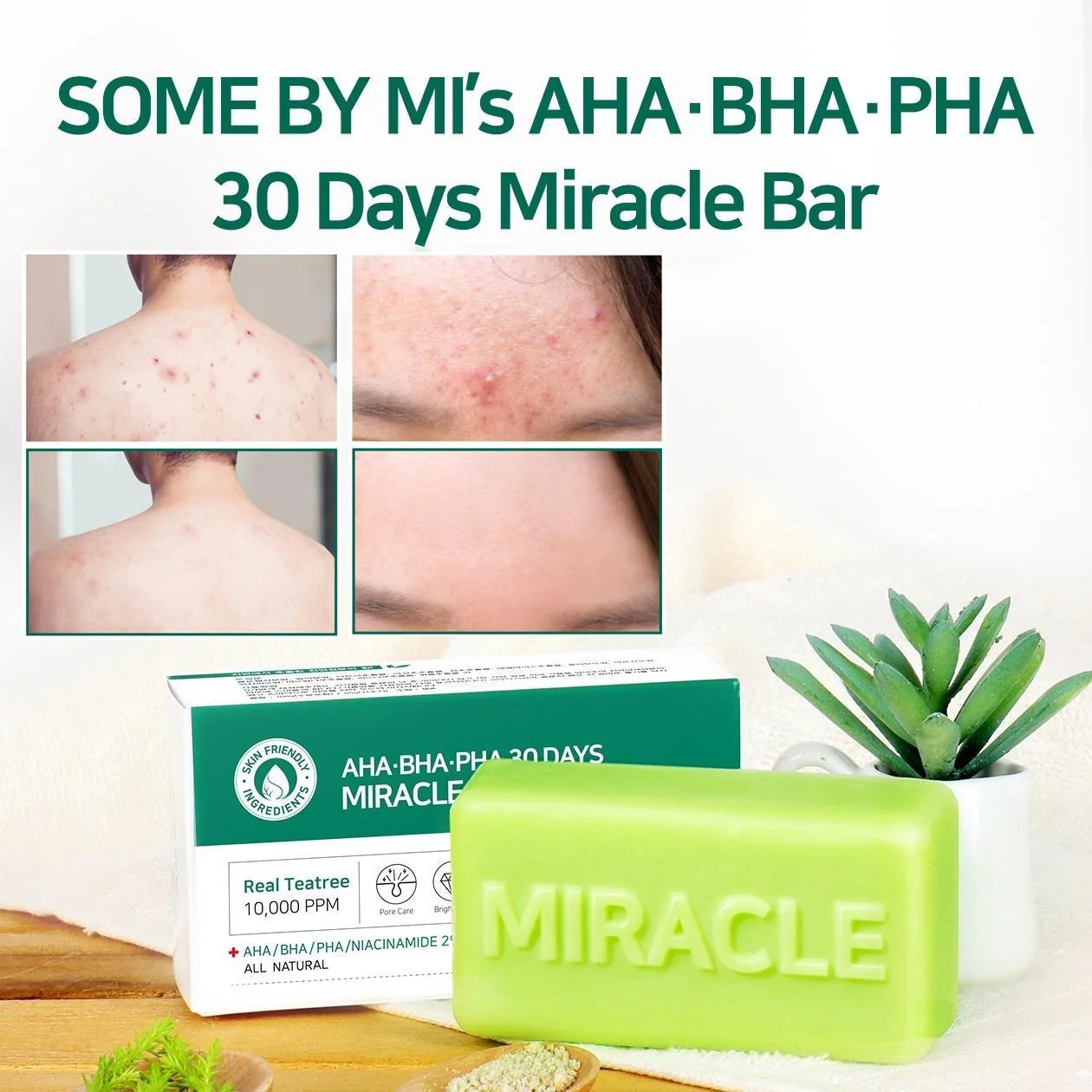 Some By Mi AHA BHA PHA 30 Days Miracle Cleansing Bar – Visible improvement in acne reduction, skin brightness, and smoother texture over 30 days.
